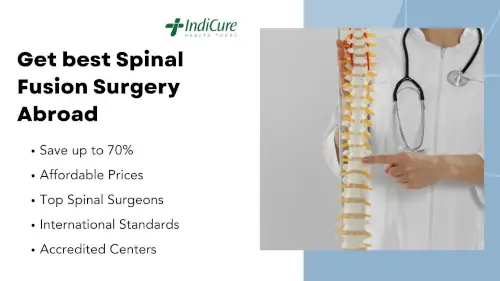 Get the best Spinal Fusion Surgery Abroad